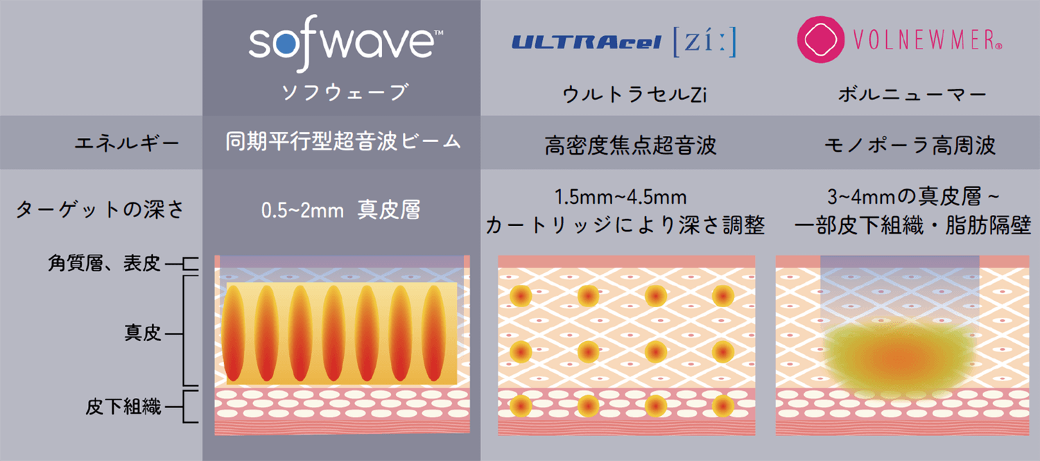 ソフウェーブとその他たるみ治療の比較