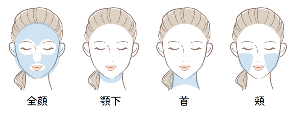 ソフウェーブ　施術範囲