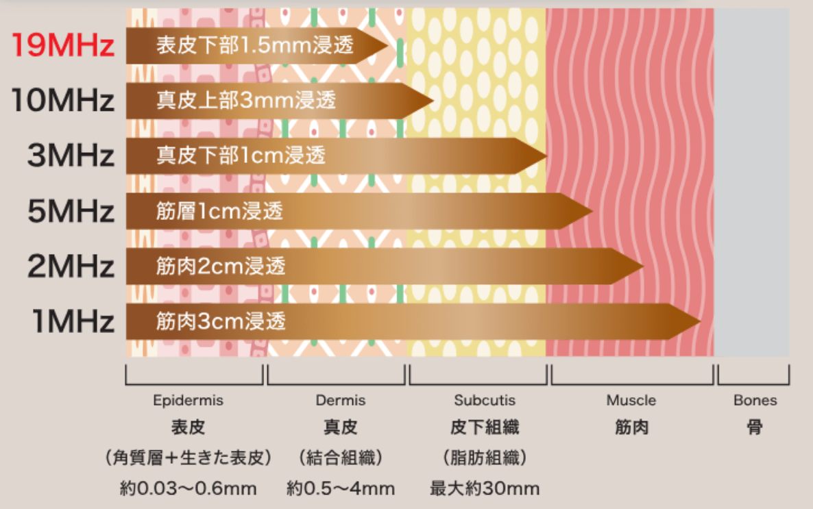 交差波長(Quattro設計)で肌再生×リフティングが同時に可能