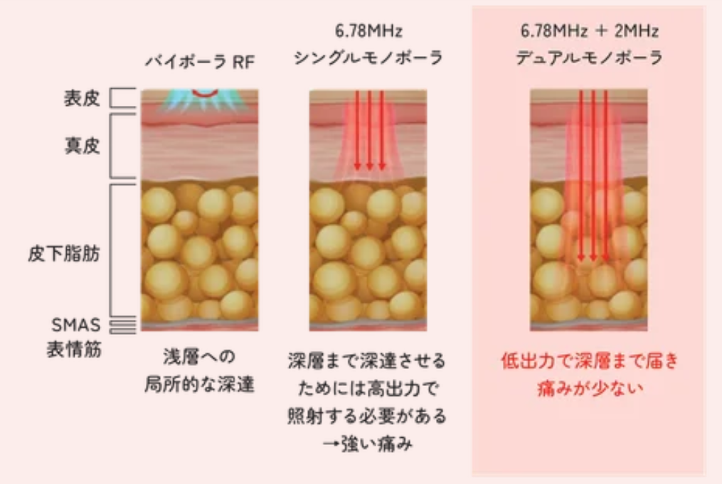 XERFの特長