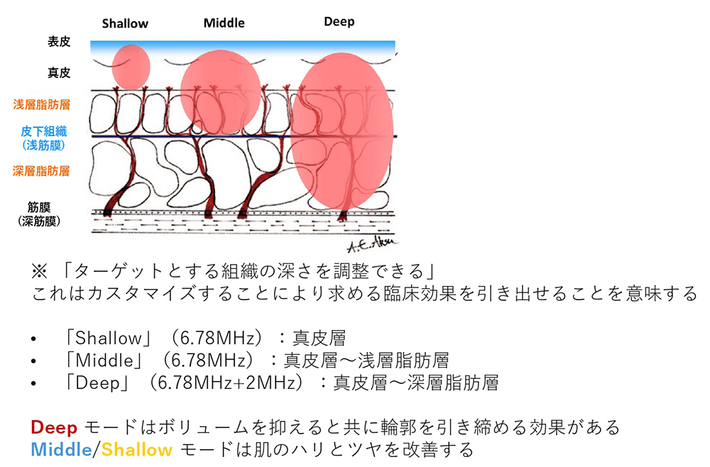 3つのモードによる層別治療